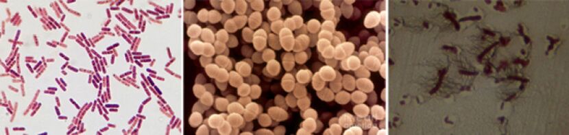 Escherichia sticks, fecal enterococcus and pro - the main pathogens of chronic bacterial prostatitis